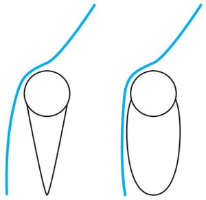Windflow