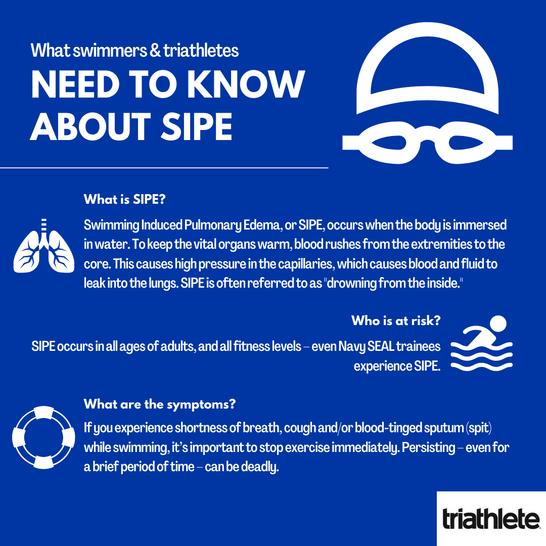 SIPE symptoms infographic