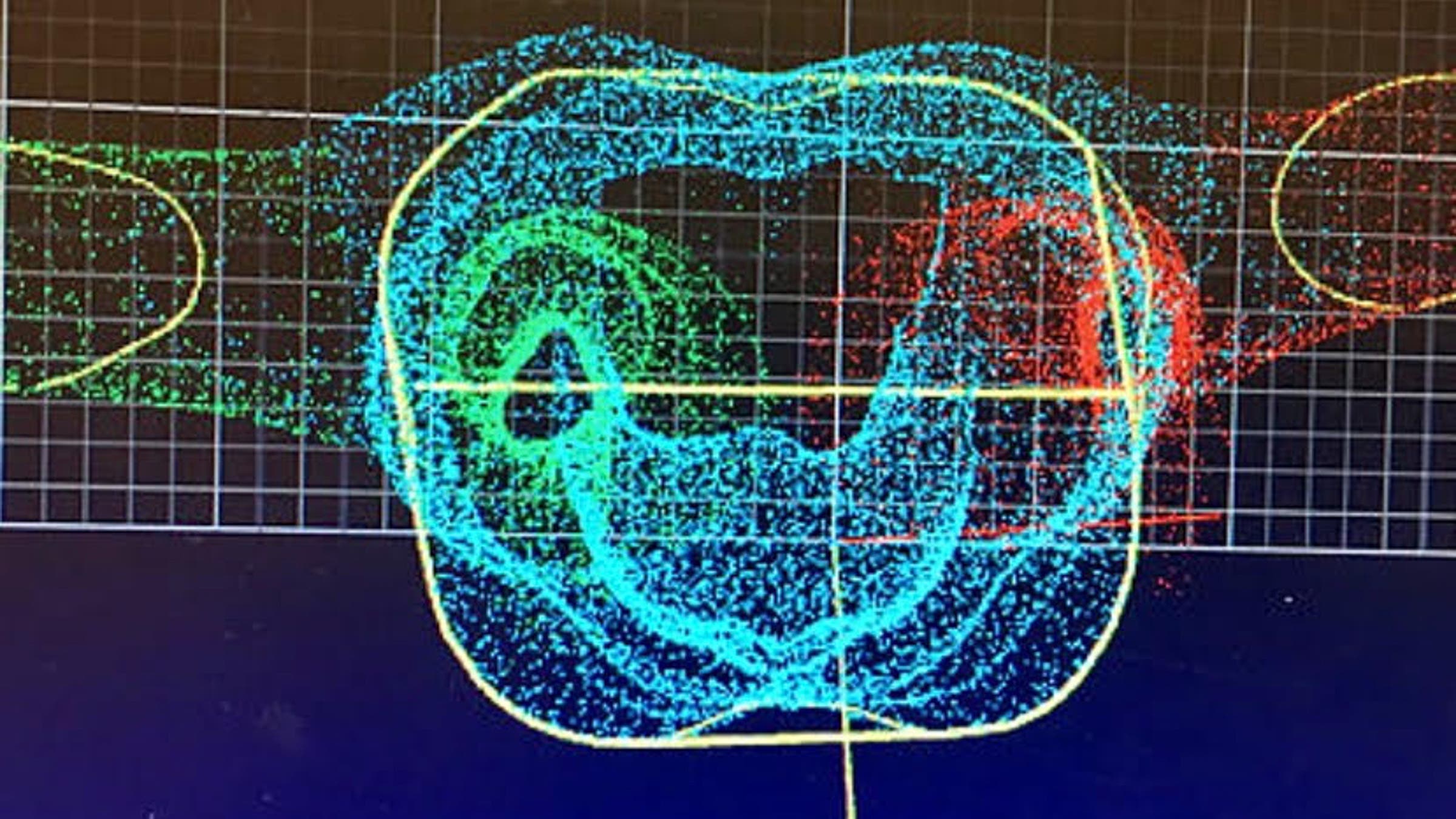 3D body scan to assess bra fit and breast position