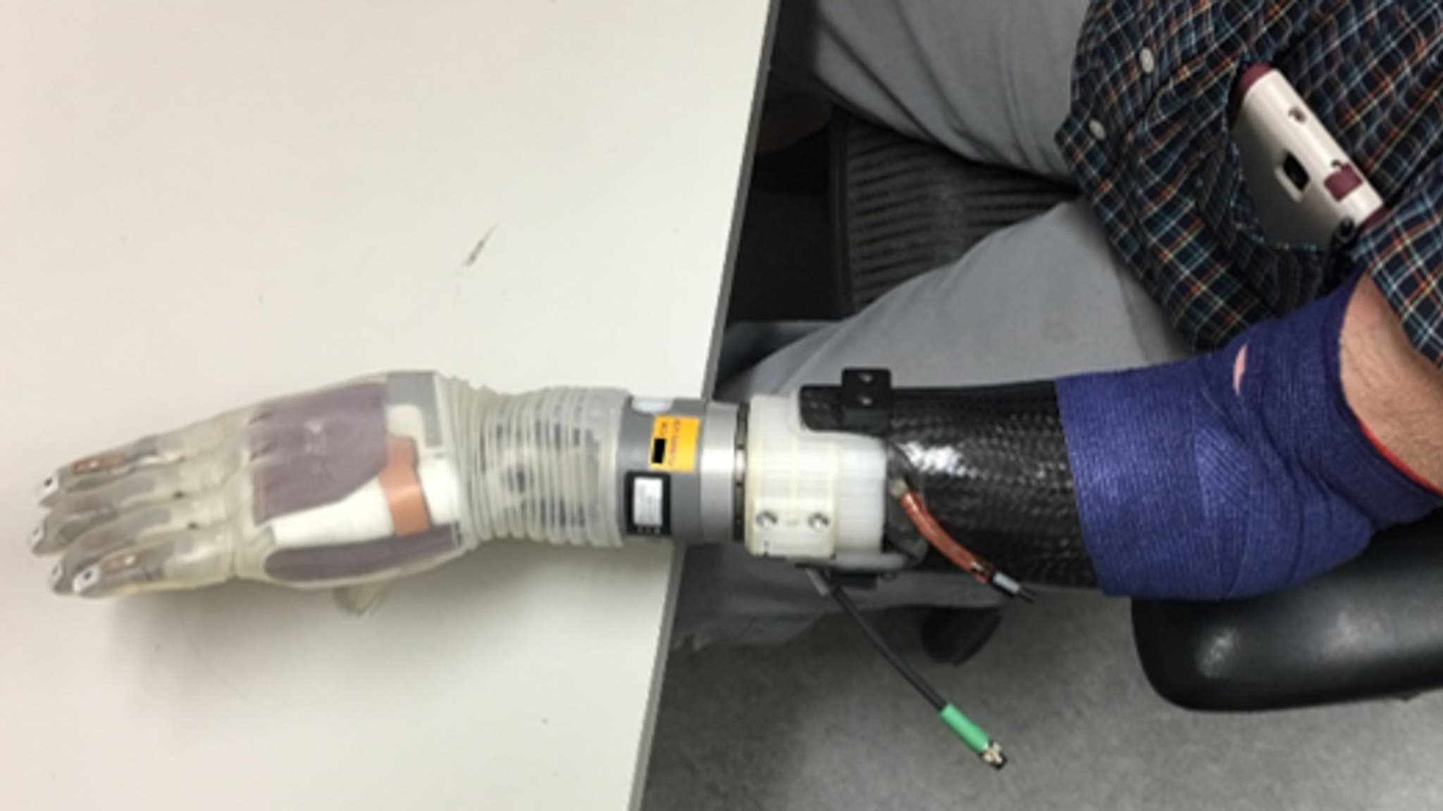 The DEKA LUKE prosthetic arm