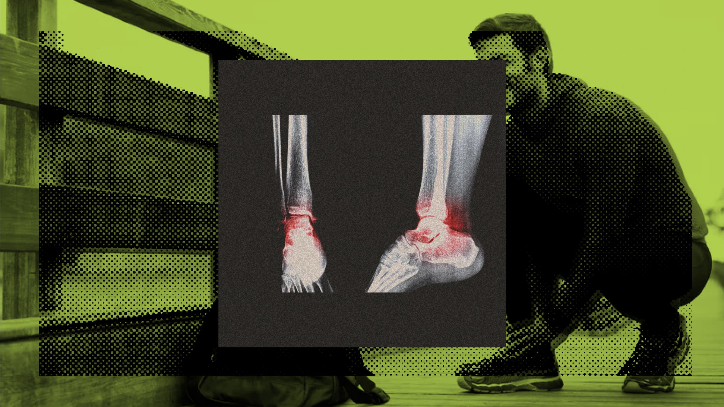 A man suffers one of the 8 most common injuries among athletes