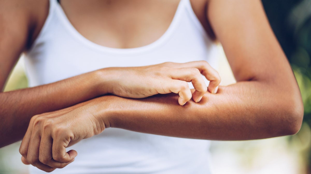 Why Do I Get Dry Skin After Swimming? Triathlete