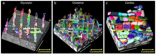 A microscopic view of three types of Mitochondria contraction