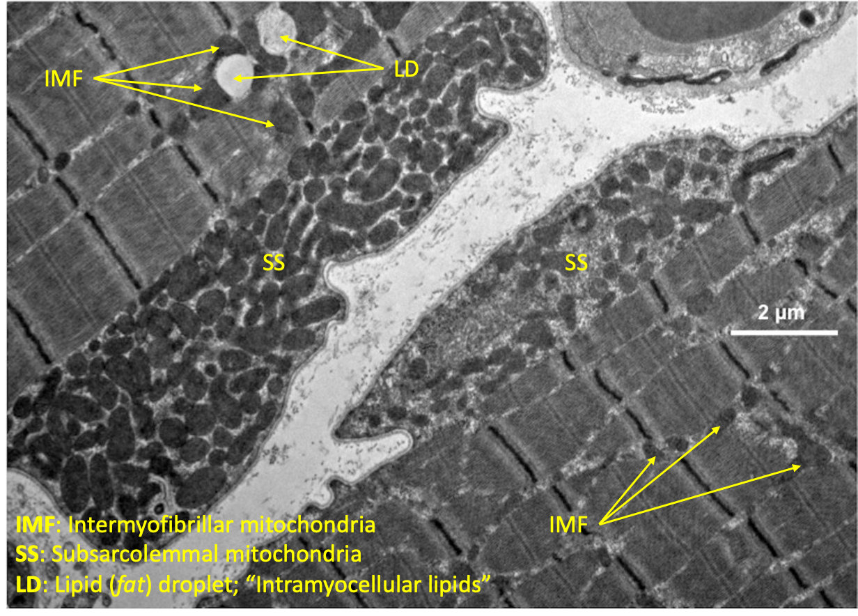 a microscopic view of the different types of mitochondria found in athletes