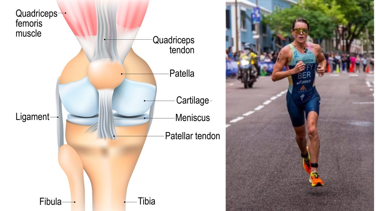 What is Patellar Tendinopathy? Understanding Flora Duffy's Injury