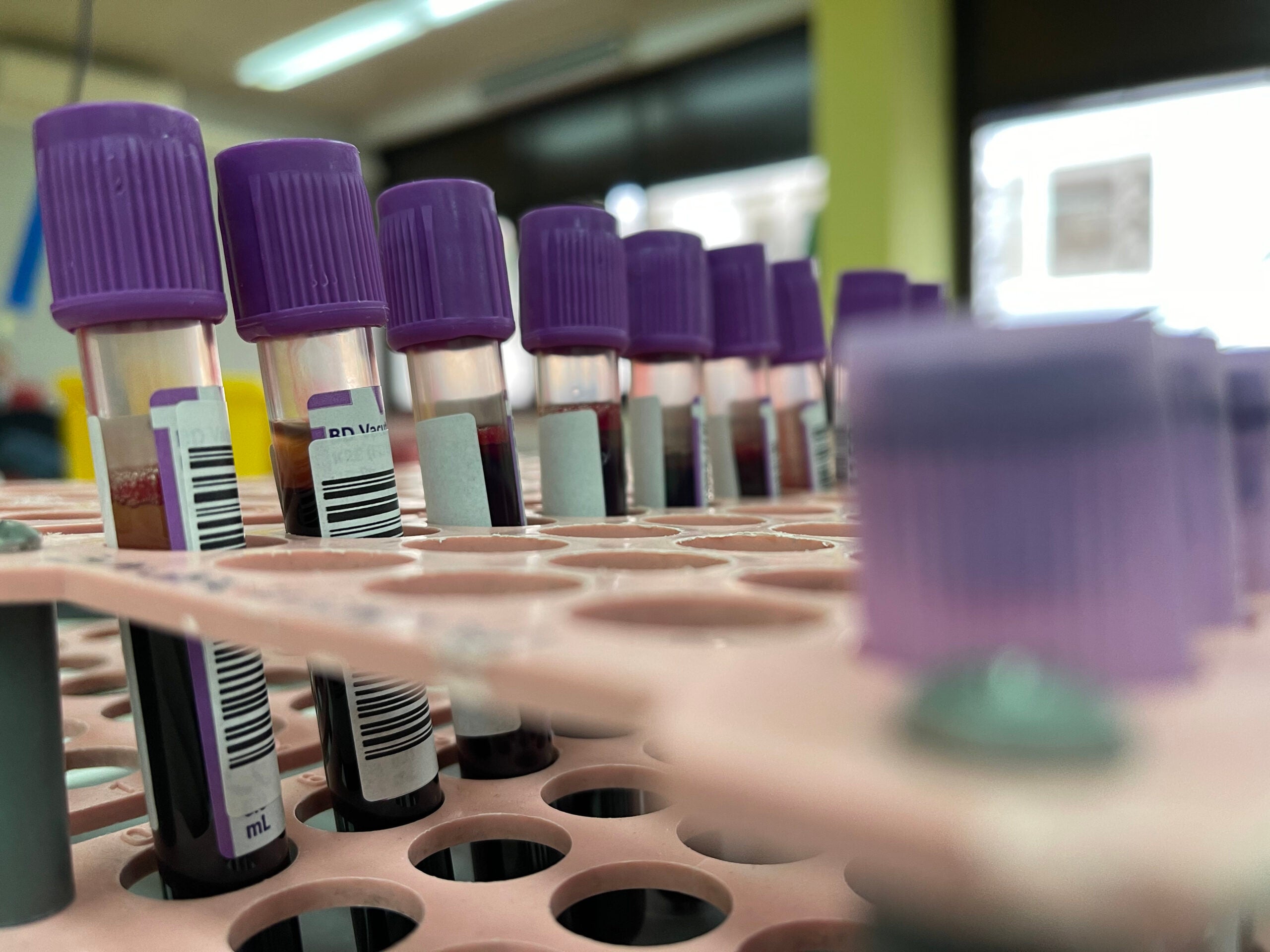 A row of blood vials for drug testing in triathlon