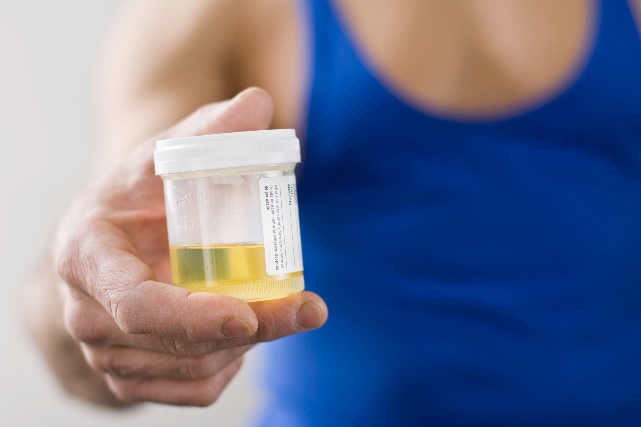 Man holding urine sample for drug testing in triathlon.