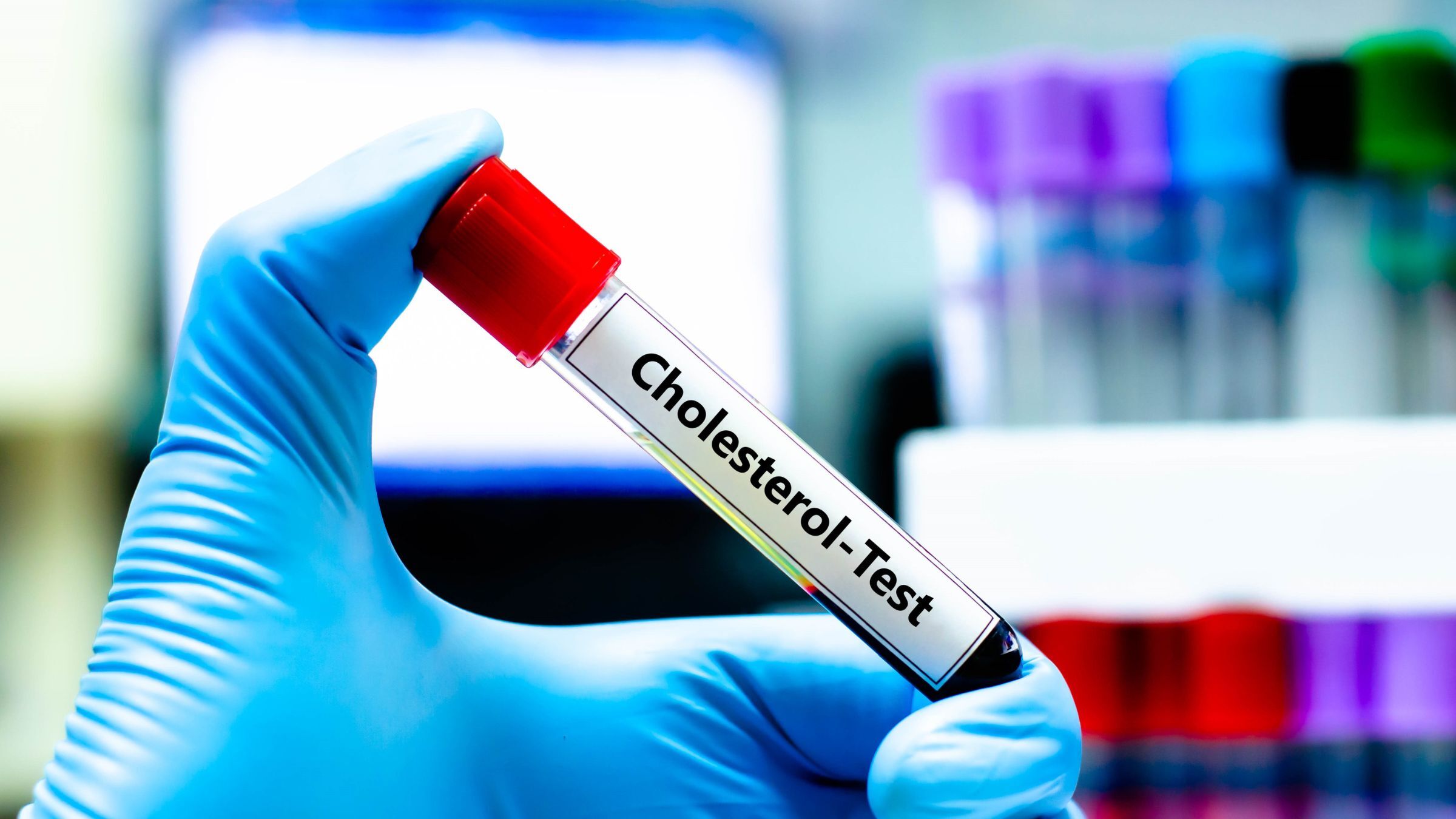 A new study reveals that there may be benefits to more advanced lipid testing in triathletes.